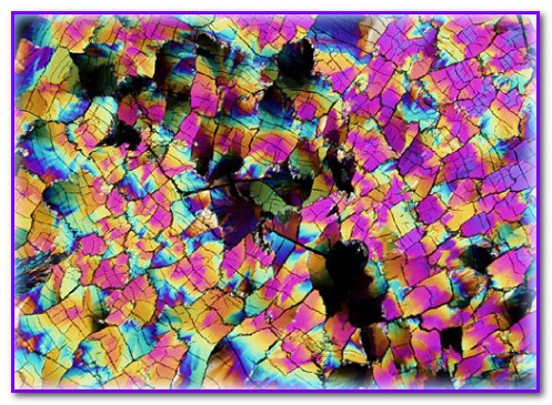 Polarized Light Digital Image Gallery1_جندي شاپور البرز_کلسترول.jpg